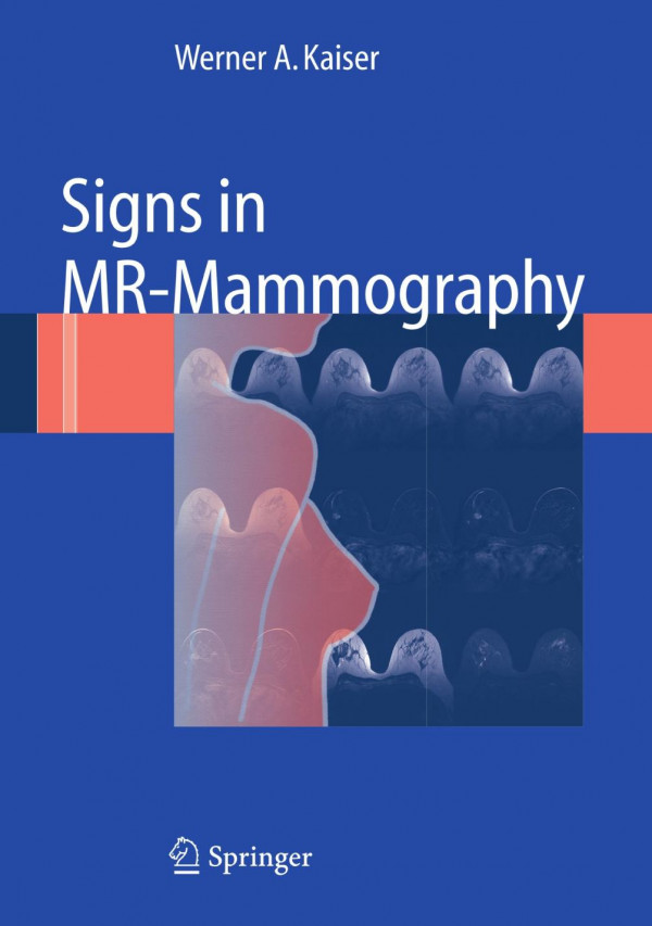 Signs In Mrmammography 1st Edition Werner A Kaiser Auth