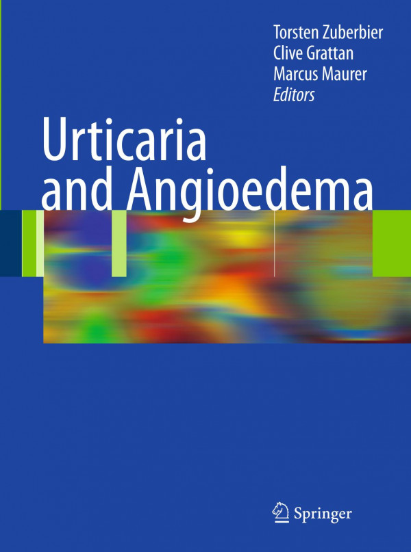 Urticaria And Angioedema 1st Edition M Greaves Auth Torsten Zuberbier