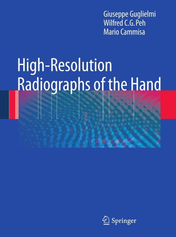 Highresolution Radiographs Of The Hand 1st Edition Giuseppe Guglielmi