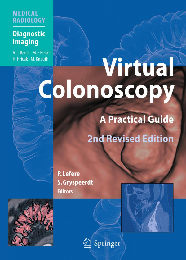 Virtual Colonoscopy A Practical Guide 2nd Edition Richard M Mendelson Auth