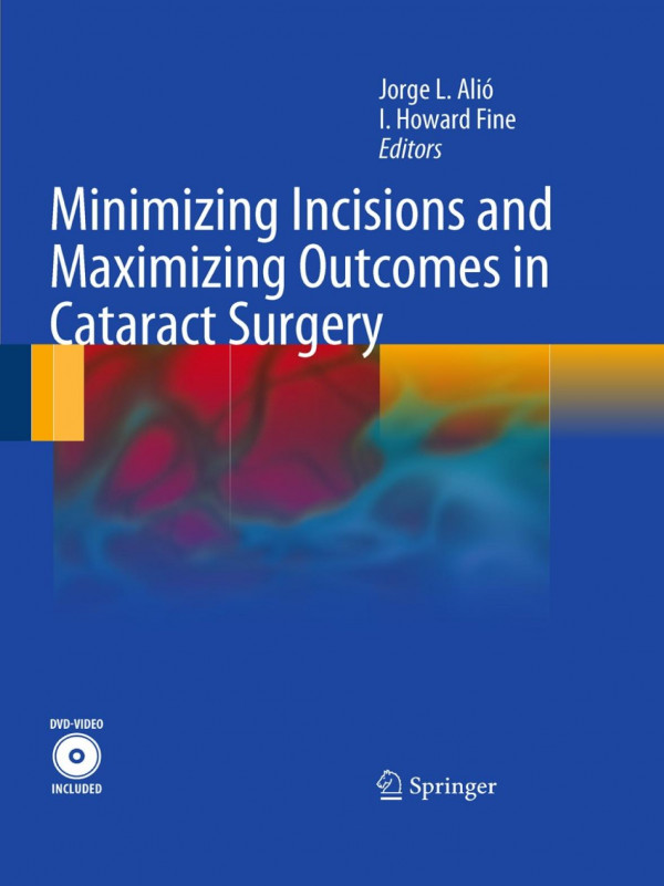 Minimizing Incisions And Maximizing Outcomes In Cataract Surgery 1st Edition I Howard Fine