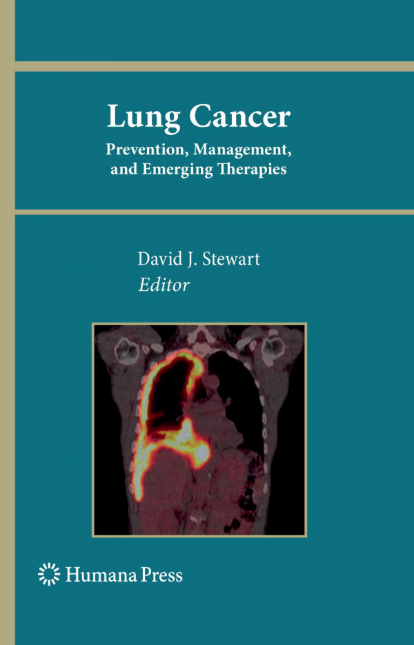 Lung Cancer Prevention Management And Emerging Therapies 1st Edition Alejandro Corvalan