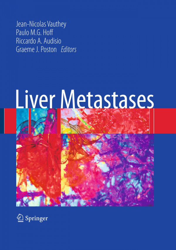 Liver Metastases 1st Edition Carlos Valls Laura Martnez Sandra Ruiz