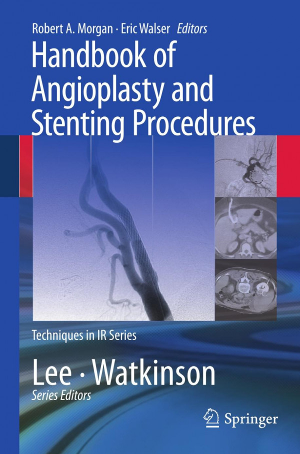 Handbook Of Angioplasty And Stenting Procedures 1st Edition David O Kessel Auth