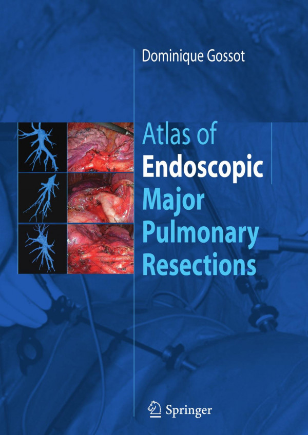 Atlas Of Endoscopic Major Pulmonary Resections 1st Edition Dominique Gossot Auth