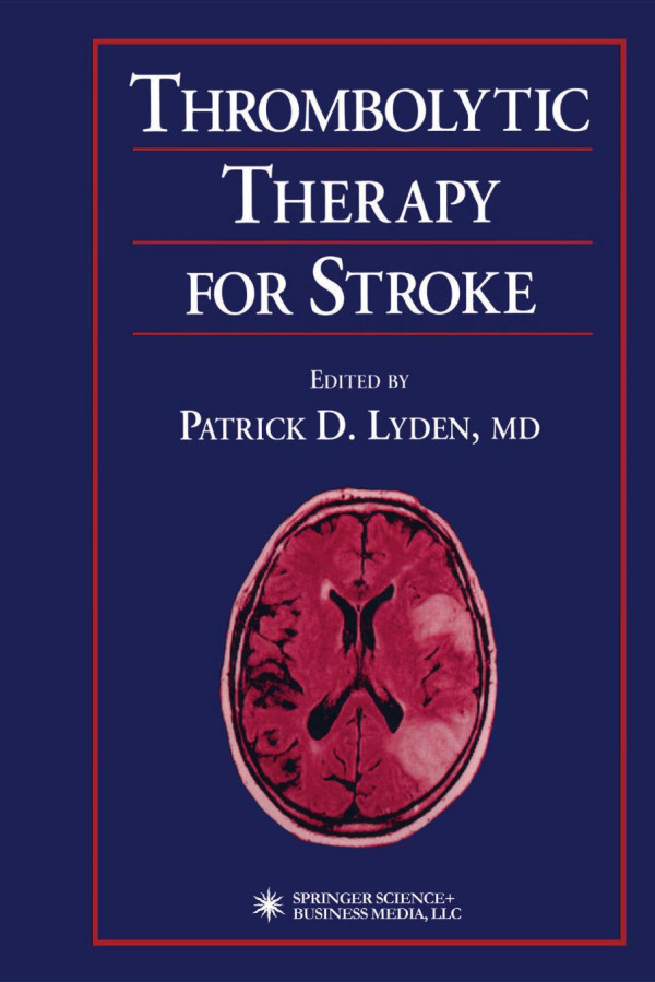 Thrombolytic Therapy For Stroke Gregory J Del Zoppo Md Naohisa Hosomi Md