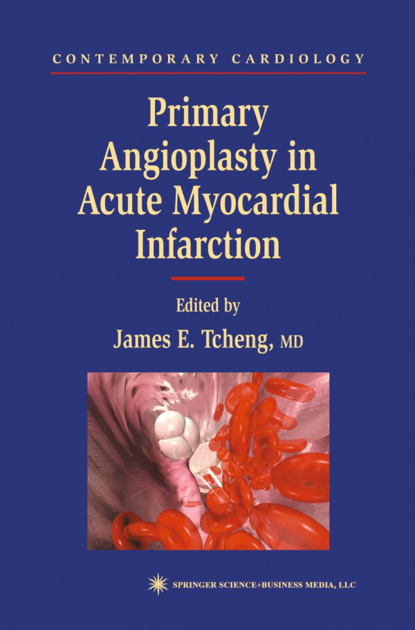 Primary Angioplasty In Acute Myocardial Infarction Warren J Cantor Md Auth
