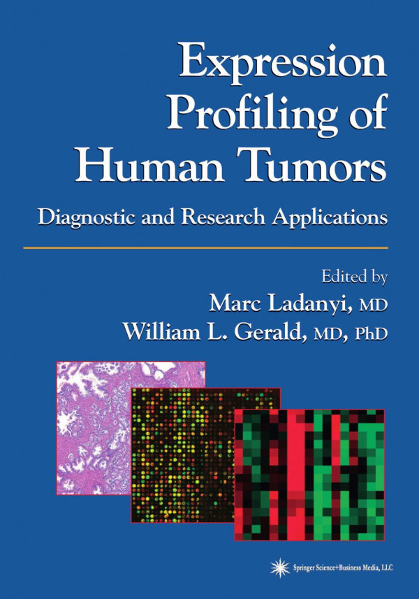 Expression Profiling Of Human Tumors Diagnostic And Research Applications 1st Edition Marc Ladanyi