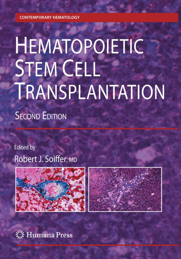 Hematopoietic Stem Cell Transplantation 2nd Edition Elizabeth O Hexner