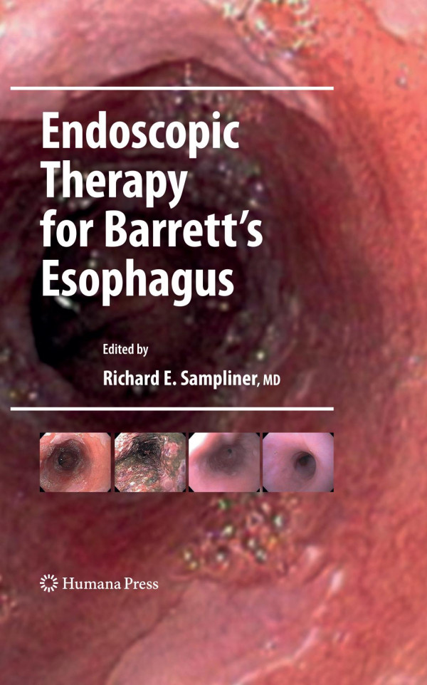 Endoscopic Therapy For Barretts Esophagus 1st Edition Herbert C Wolfsen Md Auth