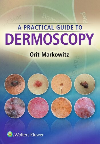 A Practical Guide To Dermoscopy 1st Edition Orit Markowitz