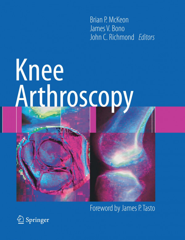 Knee Arthroscopy 1st Edition Anthony Schena Glen Ross Md Auth