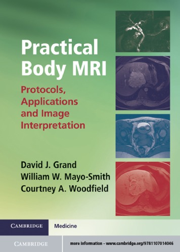 Practical Body Mri Protocols Applications And Image Interpretation Woodfield