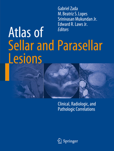 Atlas Of Sellar And Parasellar Lesions Gabriel Zada M Beatriz S Lopes