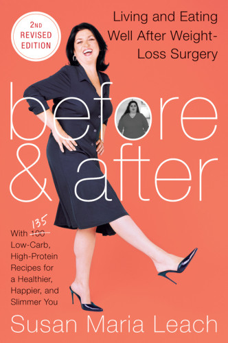 Before After Living Eating Well After Weightloss Surgery Second Revised Edition Leach