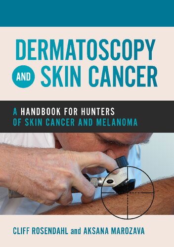 Dermatoscopy And Skin Cancer A Handbook For Hunters Of Skin Cancer And Melanoma 1st Edition Cliff Rosendahl Author