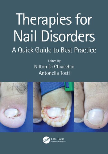 Therapies For Nail Disorders A Quick Guide To Best Practice 1st Nilton Di Chiacchio