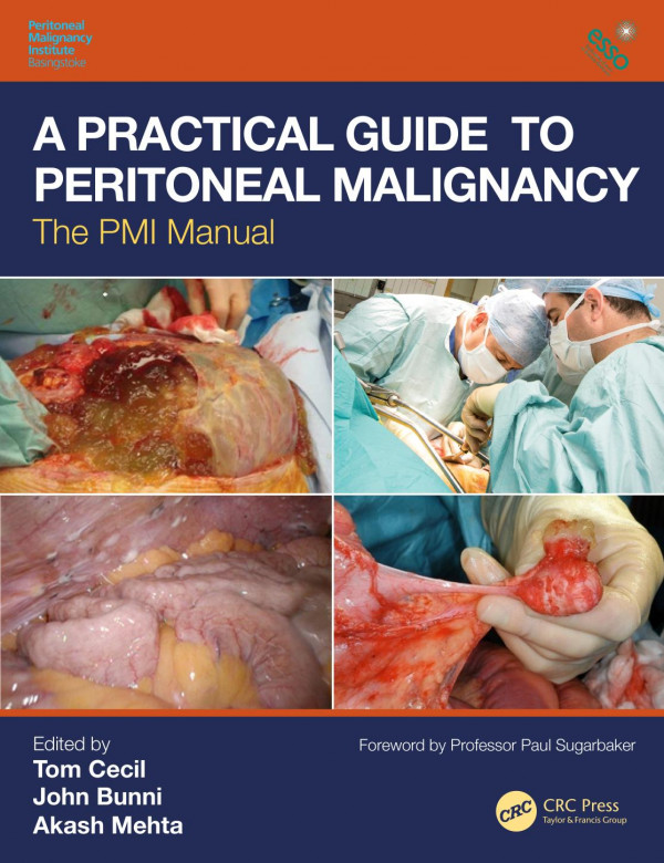 A Practical Guide To Peritoneal Malignancythe Pmi Manual 1st Edition Tom Cecil Editor John Bunni Editor Akash Mehta Editor