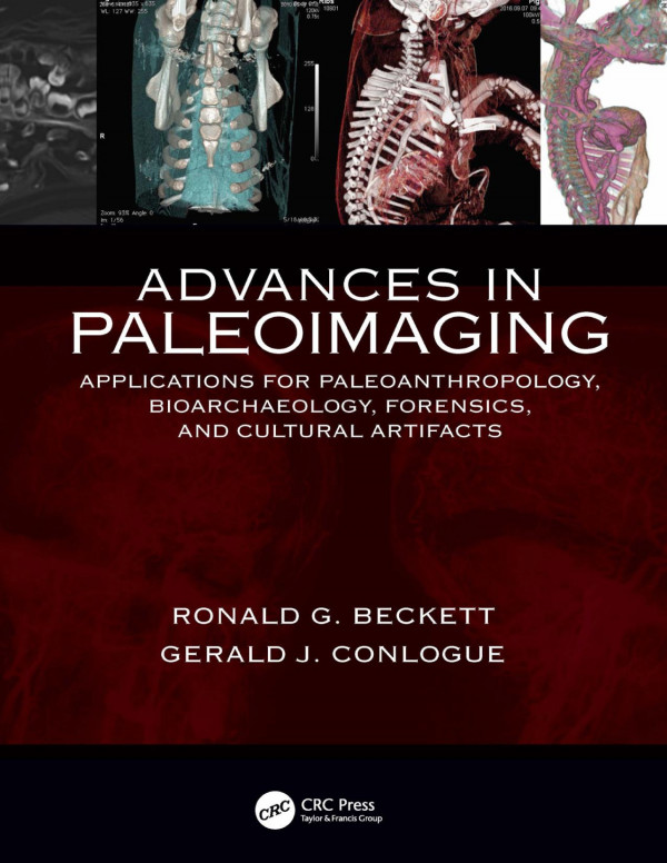 Advances In Paleoimagingapplications For Paleoanthropology Bioarchaeology Forensics And Cultural Artifacts 1st Edition Gerald J Conlogue Author Ronald G Beckett Author