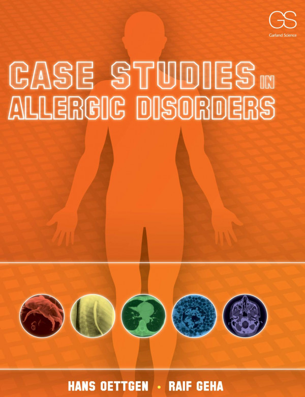 Case Studies In Allergic Disorders 1st Edition Hans Oettgen Author Raif Geha Author