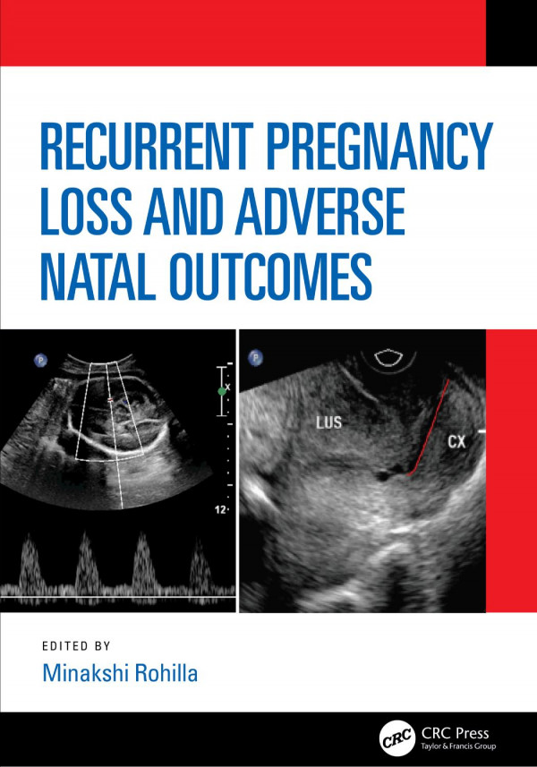 Recurrent Pregnancy Loss And Adverse Natal Outcomes 1st Edition Minakshi Rohilla Editor