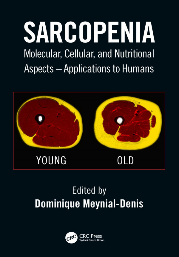Sarcopeniamolecular Cellular And Nutritional Aspects 1st Edition Dominique Meynialdenis Editor