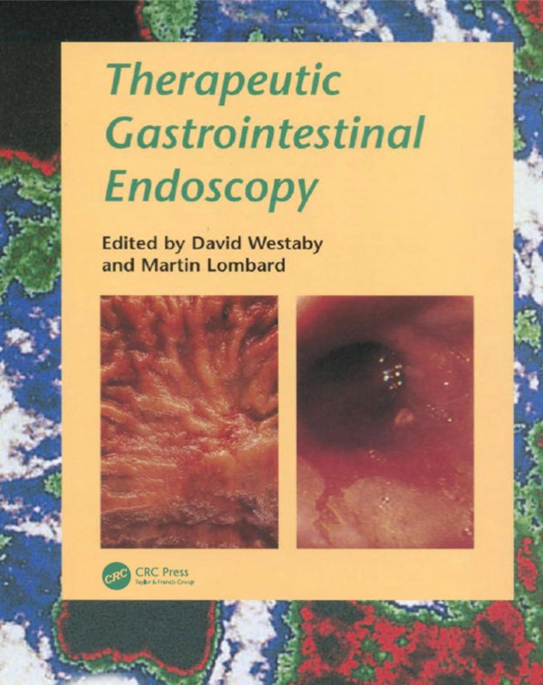 Therapeutic Gastrointestinal Endoscopy 1st Edition David Westaby Editor Martin Lombard Editor