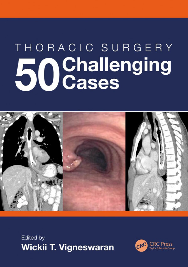 Thoracic Surgery 50 Challenging Cases 1st Edition Wickii Vigneswaran Editor