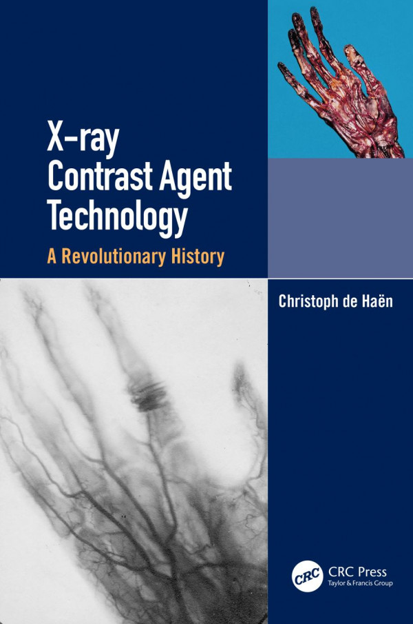 Xray Contrast Agent Technologya Revolutionary History 1st Edition Christoph De Haen Author
