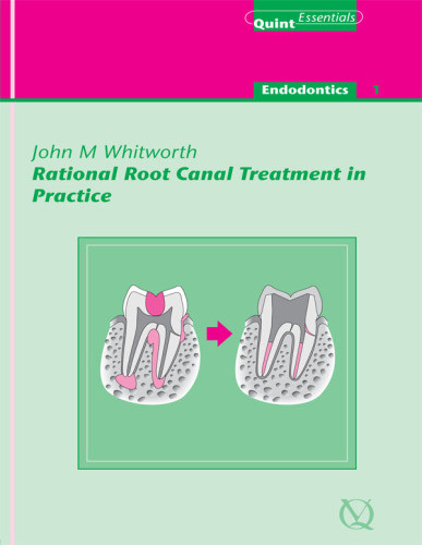 Rational Root Canal Treatment In Practice Quintessentials Of Dental Practice Vol 2 Whitworth