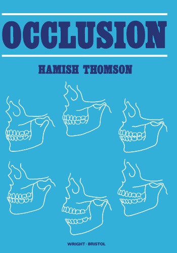 Occlusion Thomson Hamish