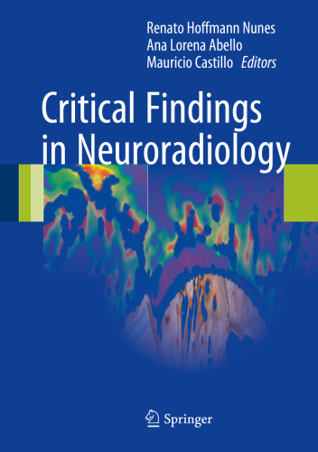 Critical Findings In Neuroradiology Renato Hoffmann Nunes Ana Lorena Abellomauricio Castillo