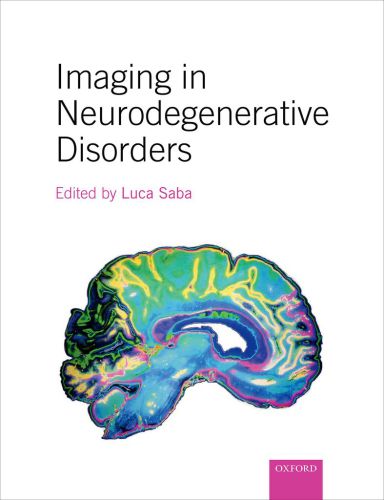 Imaging In Neurodegenerative Disorders Saba Luca
