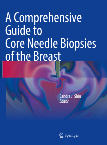 A Comprehensive Guide To Core Needle Biopsies Of The Breast Sandra J Shin