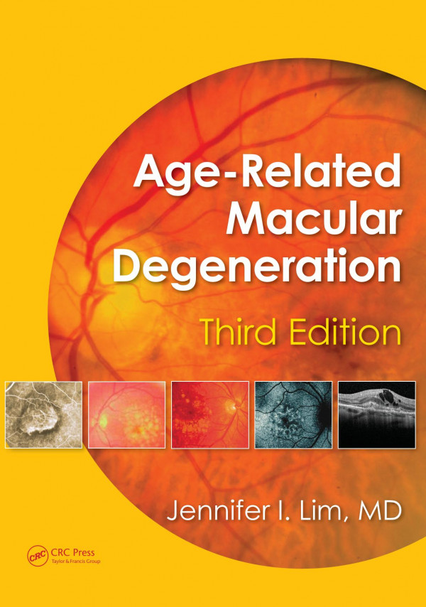 Agerelated Macular Degeneration 3rd Edition Jennifer I Lim Editor