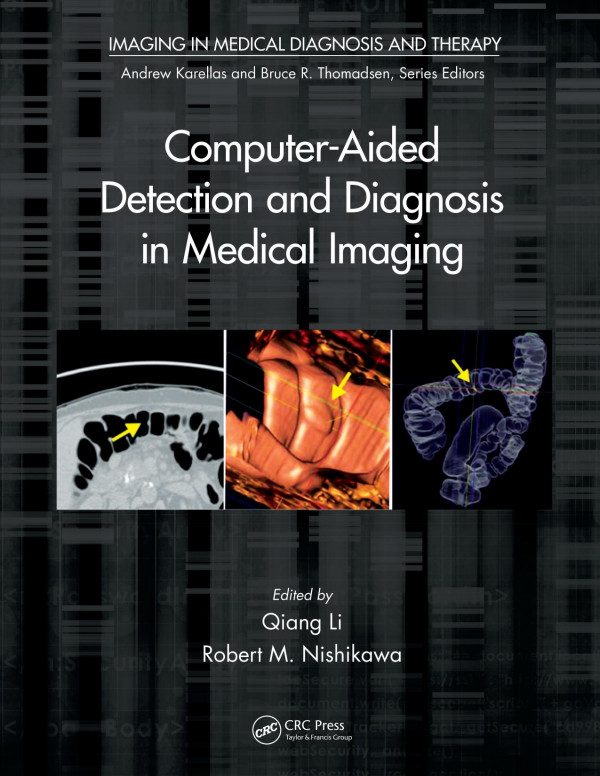 Computeraided Detection And Diagnosis In Medical Imaging 1st Edition Qiang Li Editor Robert M Nishikawa Editor