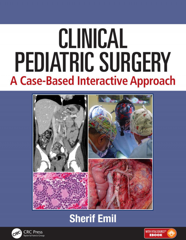 Clinical Pediatric Surgery A Casebased Interactive Approach 1st Edition Sherif Emil Author
