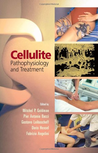 Cellulite Pathophysiology And Treatment 1st Edition Mitchel P Goldman