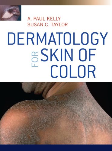 Dermatology For Skin Of Color 1st Edition A Paul Kelly Susan Taylor