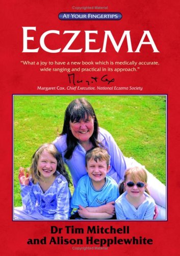Eczema The At Your Fingertips Guide Tim Mitchell Alison Hepplewhite