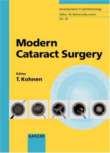 Modern Cataract Surgery 1st Edition Thomas Kohnen