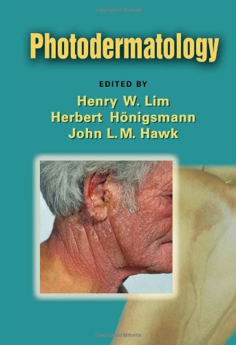 Photodermatology 1st Edition Henry W Lim Herbert Honigsmann
