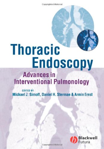 Thoracic Endoscopy Advances In Interventional Pulmonology 1st Edition Michael J Simoff Md