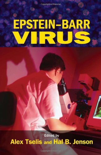 Epsteinbarr Virus 1st Edition Tselis Alex Hal B Jenson