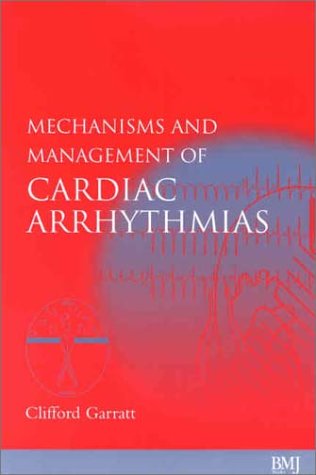 Mechanisms And Management Of Cardiac Arrhythmias 1st Edition Clifford Garratt