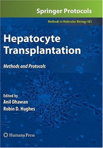 Hepatocyte Transplantation Methods And Protocols Juliana Puppi