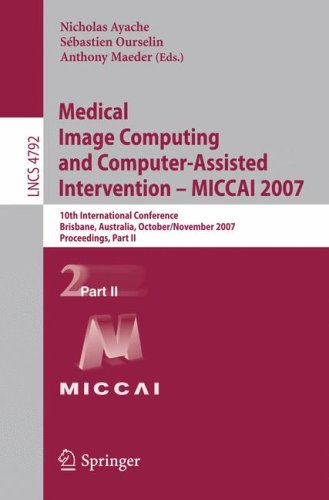 Medical Image Computing And Computerassisted Intervention Miccai 2007 10th International Conference Brisbane Australia October 29 November 2 2007 Proceedings Part Ii 1st Edition Alexandre Krupa