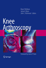 Knee Arthroscopy 1st Edition Anthony Schena Glen Ross Md Auth