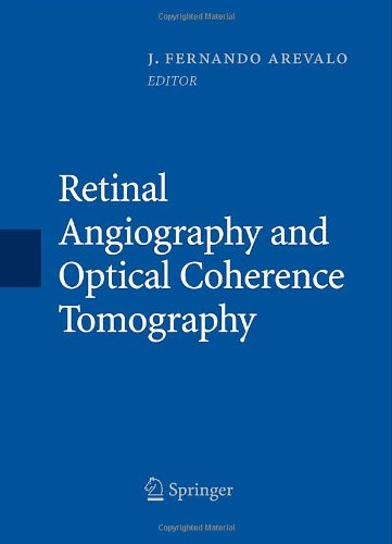 Respiratory Management In Critical Care 1st Edition J Fernando Arevalo