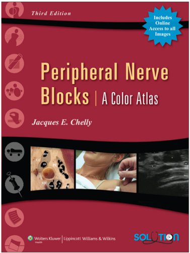 Peripheral Nerve Blocks A Color Atlas Third Jacques E Chelly